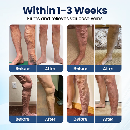Timilk® Deep Vein Repair Microneedle Patch(A)