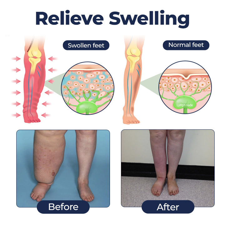 Timilk® SwellRelief Circulation Support Cream(A)