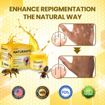 Timilk® NaturaViti Bee Venom Vitiligo Cream（A)