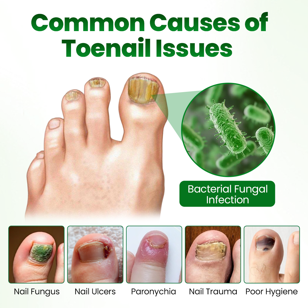 Timilk® HerbaNail 7-Day Repair Serum 🔥 FDA Certified (Clinically Proven Herbal Formula for 7-Day Nail Fungus Repair & Strength Restoration 🌿)(A)