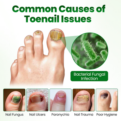 Timilk® HerbaNail 7-Day Repair Serum 🔥 FDA Certified (Clinically Proven Herbal Formula for 7-Day Nail Fungus Repair & Strength Restoration 🌿)(A)
