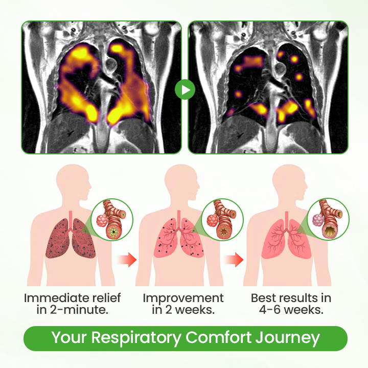 Timilk® HerbaAir Mullein Lung Purifier 🔥 (A)