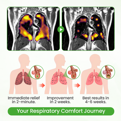 Timilk® HerbaAir Mullein Lung Purifier 🔥 (A)