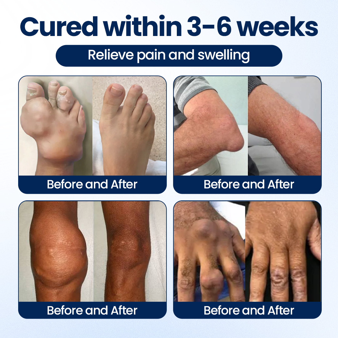 Timilk® ArthriNAD+ Pro Advanced Joint Recovery Cream🔥🔥
