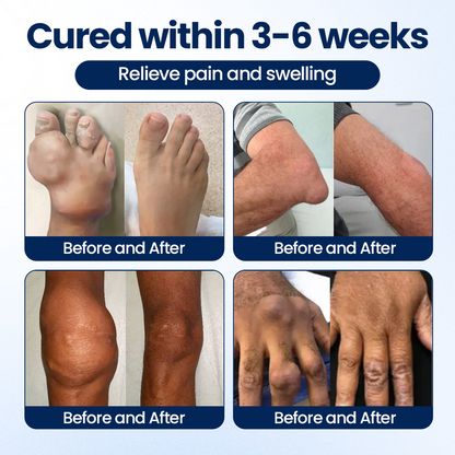 Timilk® ArthriNAD+ Pro Advanced Joint Recovery Cream🔥🔥