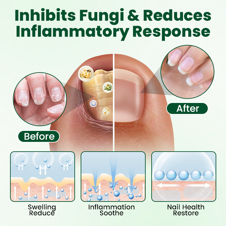 Timilk® Nail Repair Nourish Gel(A)