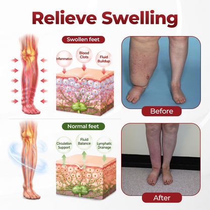 Timilk® SwellVeil Leg Circulation Cream 🔥(A)