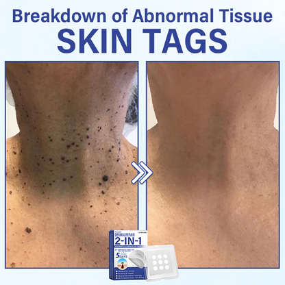 🔥Timilk® DermalRepair 2-in-1 Microneedle & Hydrocolloid Patch 💉| Raised Moles, Acne, Flat Warts & Skin Tags Remover | Improves Wrinkles, Scars & Blemishes | Invisible Pimple Patches for Face & Body💎🔥（A）