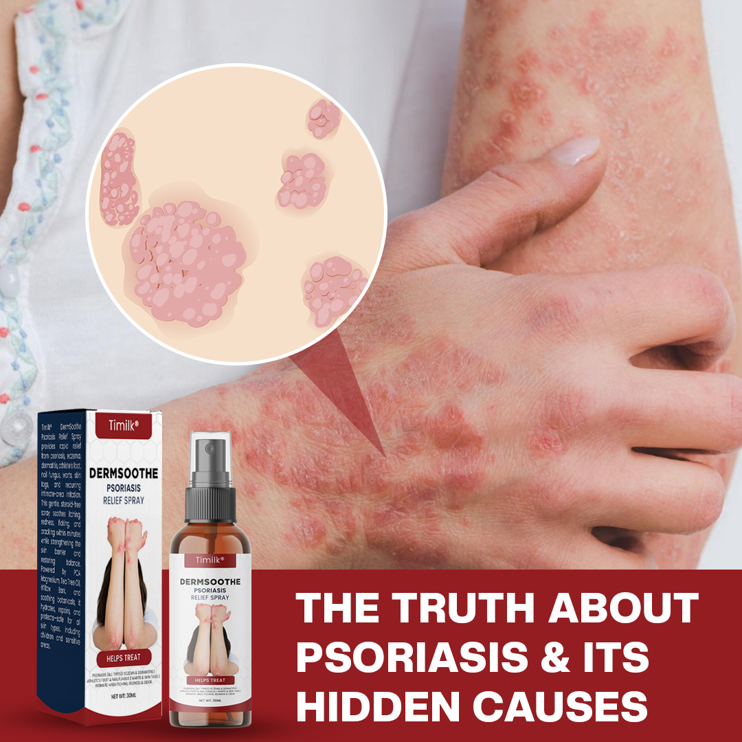 Timilk® DermSoothe Psoriasis Relief Spray(A)