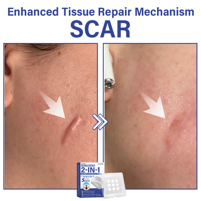 🔥Timilk® DermalRepair 2-in-1 Microneedle & Hydrocolloid Patch 💉| Raised Moles, Acne, Flat Warts & Skin Tags Remover | Improves Wrinkles, Scars & Blemishes | Invisible Pimple Patches for Face & Body💎🔥（A）
