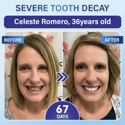 (NEW)Ceoerty® Tooth & Gum Repair Fast-Dissolving Microneedle Patch✨ (𝟓-𝐢𝐧-𝟏 💎 𝐑𝐞𝐛𝐮𝐢𝐥𝐝 𝐄𝐧𝐚𝐦𝐞𝐥 & 𝐃𝐞𝐧𝐭𝐢𝐧 • 𝐒𝐭𝐫𝐞𝐧𝐠𝐭𝐡𝐞𝐧 𝐆𝐮𝐦𝐬 • 𝐄𝐫𝐚𝐝𝐢𝐜𝐚𝐭𝐞 𝐓𝐚𝐫𝐭𝐚𝐫 & 𝐎𝐝𝐨𝐫 • 𝐖𝐡𝐢𝐭𝐞𝐧𝐢𝐧𝐠 • 𝐒𝐭𝐨𝐩 𝐓𝐨𝐨𝐭𝐡 𝐒𝐞𝐧𝐬𝐢𝐭𝐢𝐯𝐢𝐭𝐲)🔥🔥