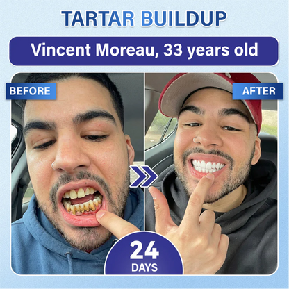 (NEW)Ceoerty® Tooth & Gum Repair Fast-Dissolving Microneedle Patch✨ (𝟓-𝐢𝐧-𝟏 💎 𝐑𝐞𝐛𝐮𝐢𝐥𝐝 𝐄𝐧𝐚𝐦𝐞𝐥 & 𝐃𝐞𝐧𝐭𝐢𝐧 • 𝐒𝐭𝐫𝐞𝐧𝐠𝐭𝐡𝐞𝐧 𝐆𝐮𝐦𝐬 • 𝐄𝐫𝐚𝐝𝐢𝐜𝐚𝐭𝐞 𝐓𝐚𝐫𝐭𝐚𝐫 & 𝐎𝐝𝐨𝐫 • 𝐖𝐡𝐢𝐭𝐞𝐧𝐢𝐧𝐠 • 𝐒𝐭𝐨𝐩 𝐓𝐨𝐨𝐭𝐡 𝐒𝐞𝐧𝐬𝐢𝐭𝐢𝐯𝐢𝐭𝐲)🔥🔥（A）