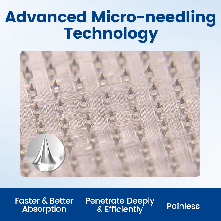 Timilk® Vein Ease Microneedle Therapy Patch - Fast ⚡Effective 💪 and Non-Invasive 🚫 Treatment for Varicose Veins & Leg Swelling 👣(A)