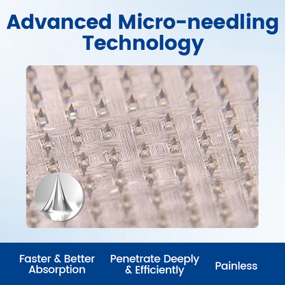 Timilk® Vein Ease Microneedle Therapy Patch - Fast ⚡Effective 💪 and Non-Invasive 🚫 Treatment for Varicose Veins & Leg Swelling 👣(A)