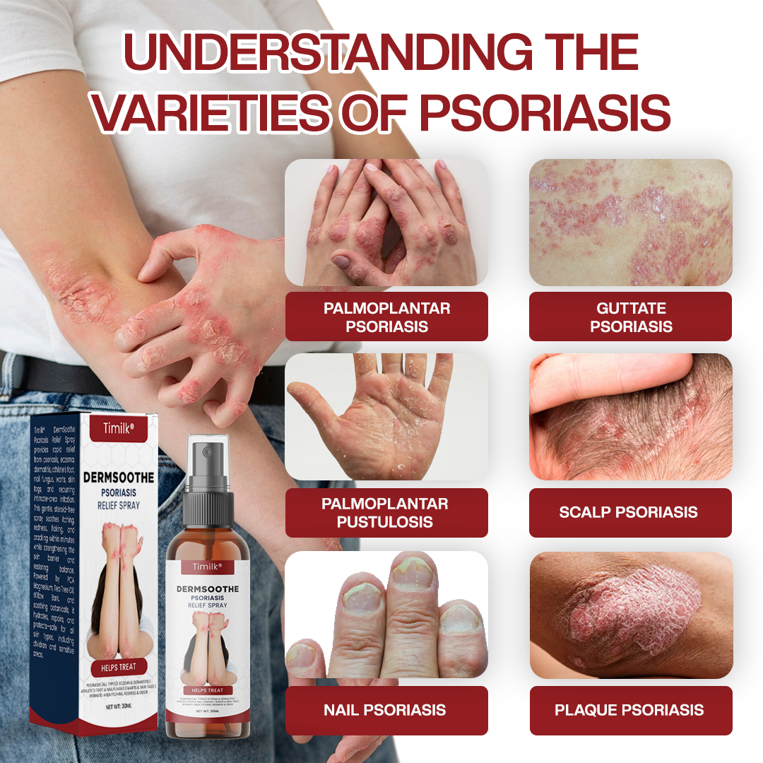 Timilk® DermSoothe Psoriasis Relief Spray(A)