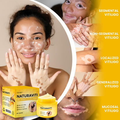 Timilk® NaturaViti Bee Venom Vitiligo Cream（A)