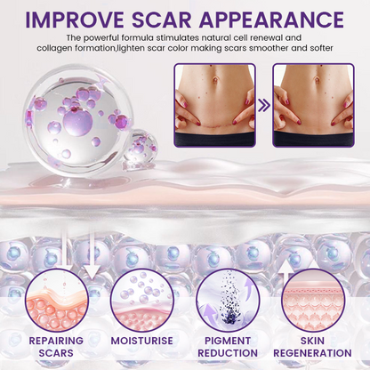 Timilk® ReGenScar Stem Cell Scar Gel (A)
