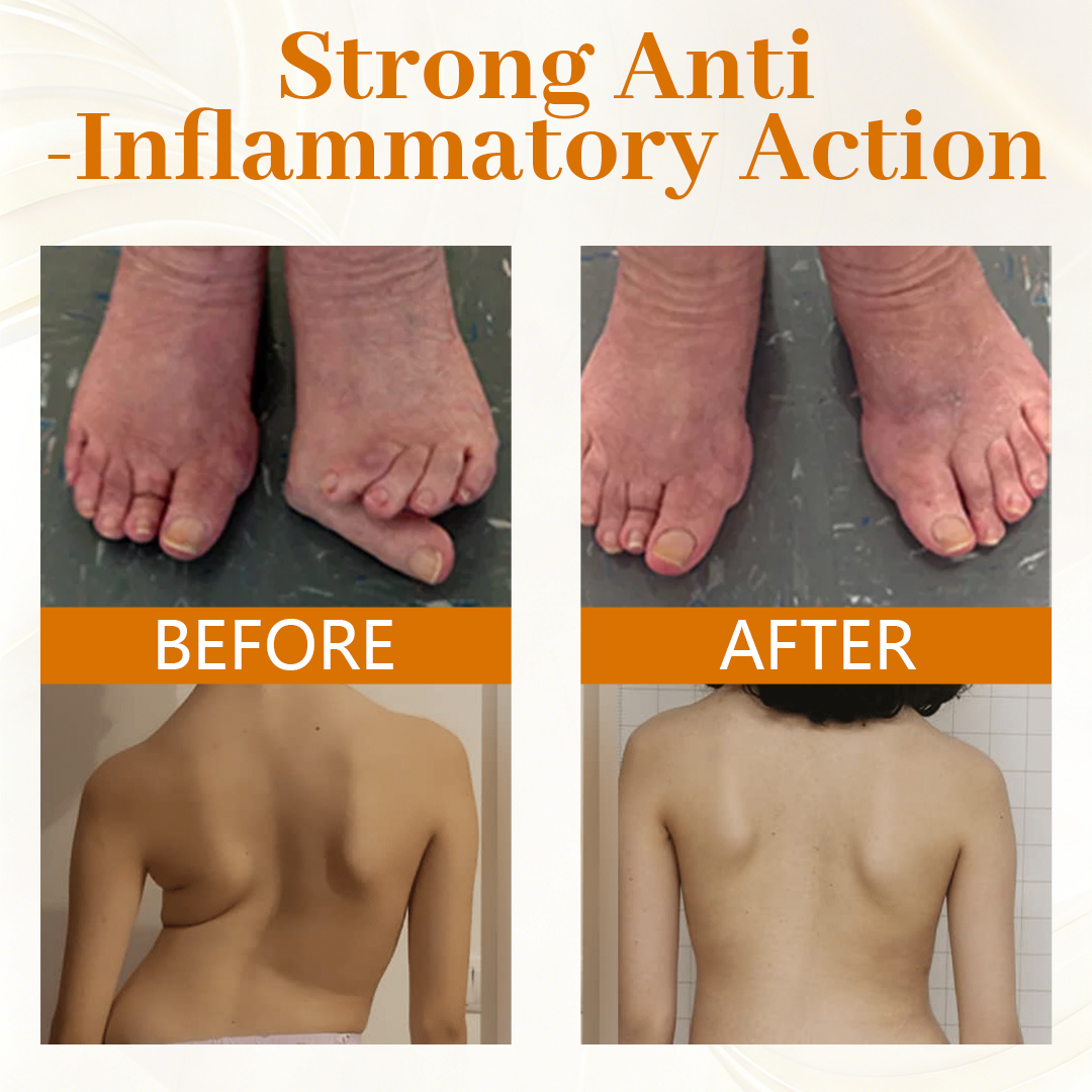 Timilk® ScorpiTakt Joint & Muscle Relief Ointment🔥(A)