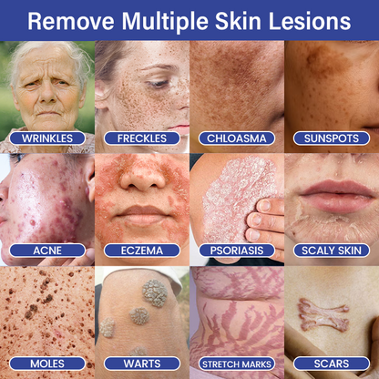 🔥Timilk® DermalRepair 2-in-1 Microneedle & Hydrocolloid Patch 💉| Raised Moles, Acne, Flat Warts & Skin Tags Remover | Improves Wrinkles, Scars & Blemishes | Invisible Pimple Patches for Face & Body💎🔥（A）