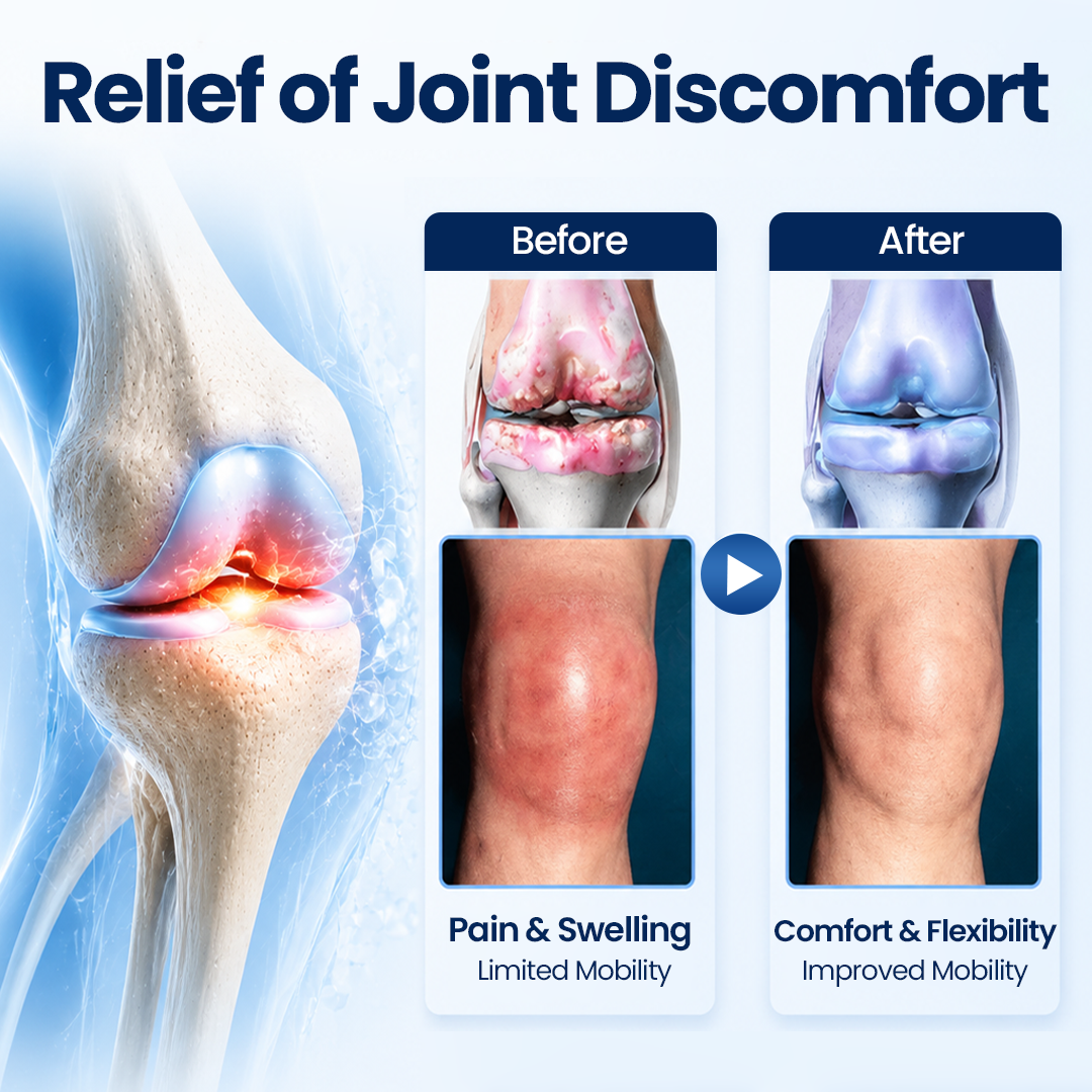 Timilk® ArthriNAD+ Pro Advanced Joint Recovery Cream🔥🔥