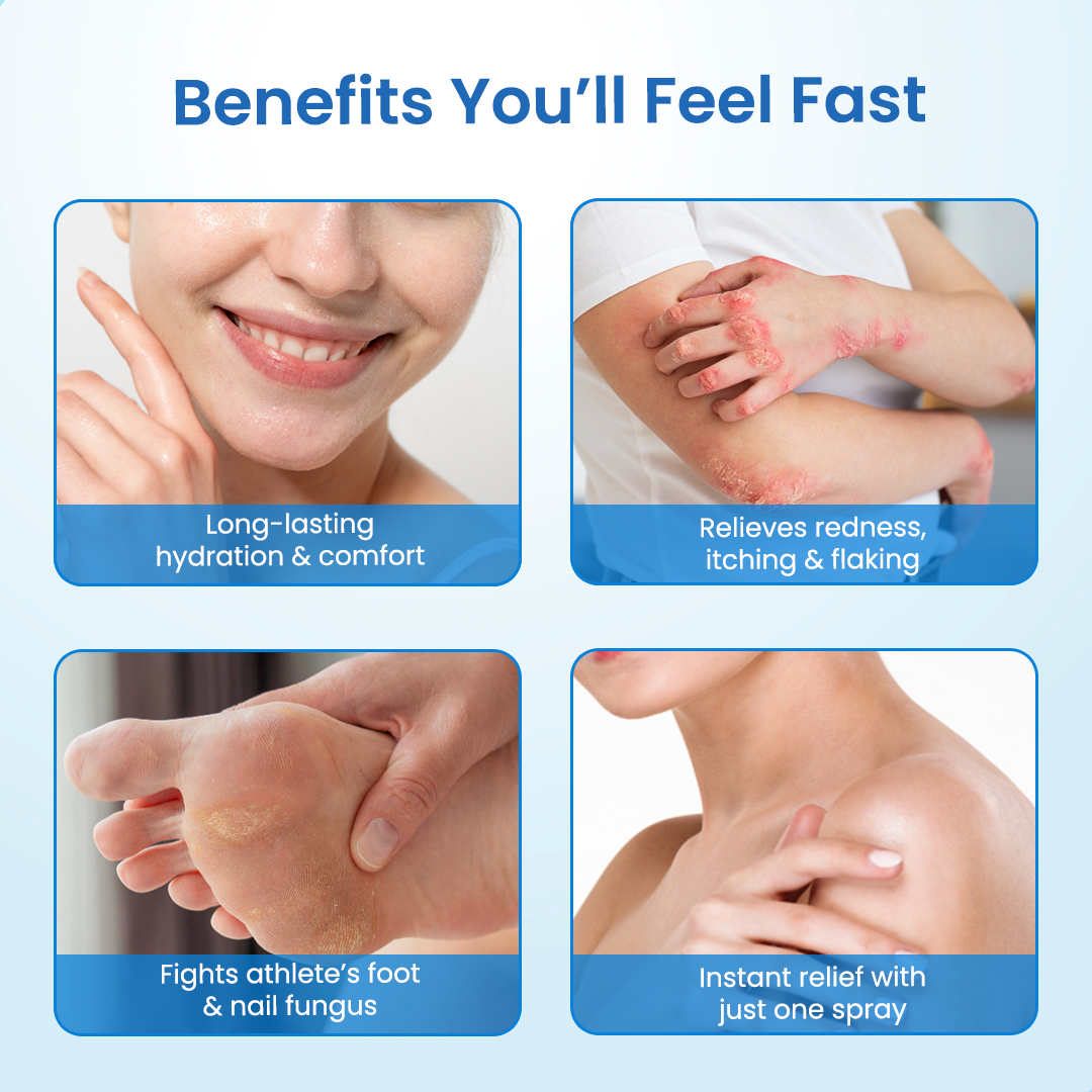 Timilk® MagnesiumHerb Psoriasis Relief Cream(A)