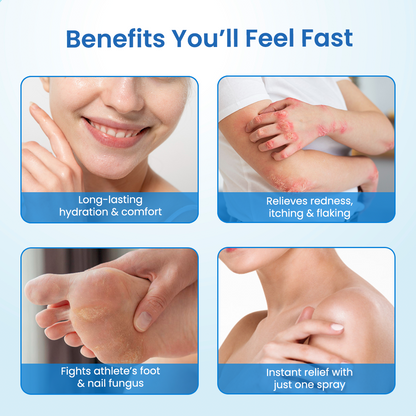 Timilk® MagnesiumHerb Psoriasis Relief Cream(A)