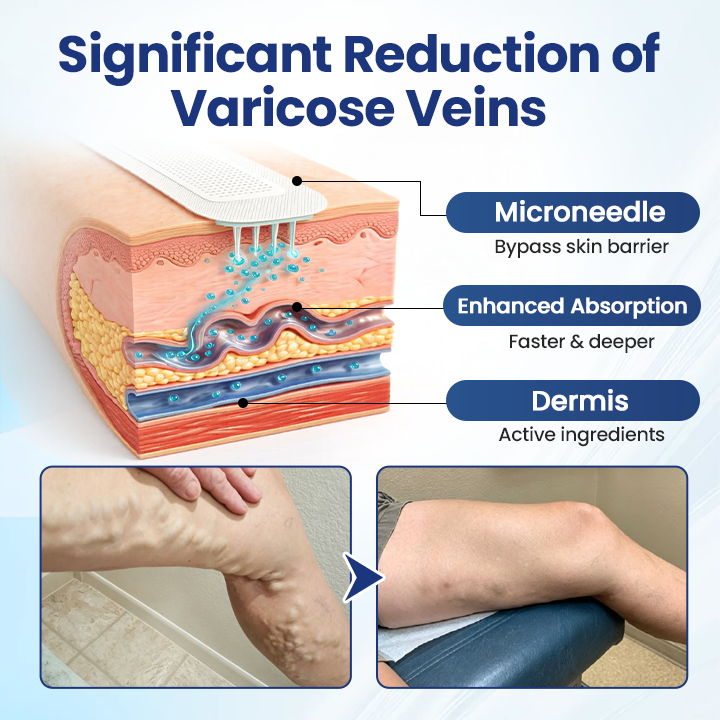 Timilk® Deep Vein Repair Microneedle Patch(A)