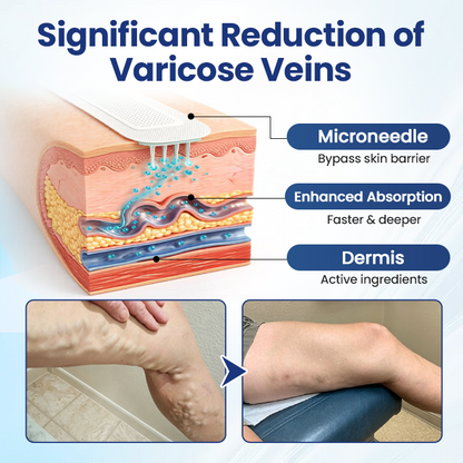 Timilk® Deep Vein Repair Microneedle Patch(A)