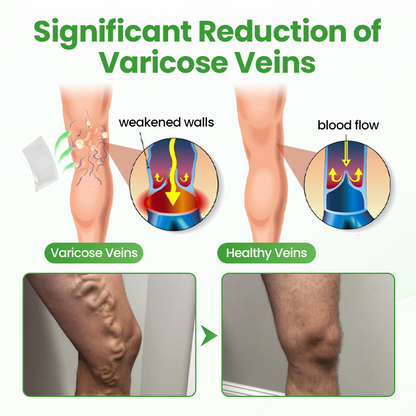 Healrize® VeinHeal Microneedle Patch,