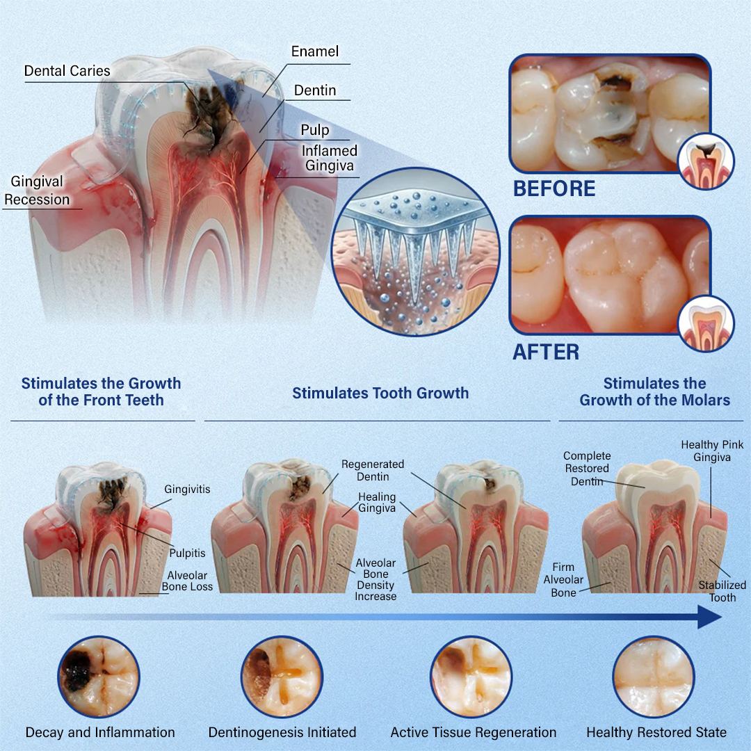 (NEW)Ceoerty® Tooth & Gum Repair Fast-Dissolving Microneedle Patch✨ (𝟓-𝐢𝐧-𝟏 💎 𝐑𝐞𝐛𝐮𝐢𝐥𝐝 𝐄𝐧𝐚𝐦𝐞𝐥 & 𝐃𝐞𝐧𝐭𝐢𝐧 • 𝐒𝐭𝐫𝐞𝐧𝐠𝐭𝐡𝐞𝐧 𝐆𝐮𝐦𝐬 • 𝐄𝐫𝐚𝐝𝐢𝐜𝐚𝐭𝐞 𝐓𝐚𝐫𝐭𝐚𝐫 & 𝐎𝐝𝐨𝐫 • 𝐖𝐡𝐢𝐭𝐞𝐧𝐢𝐧𝐠 • 𝐒𝐭𝐨𝐩 𝐓𝐨𝐨𝐭𝐡 𝐒𝐞𝐧𝐬𝐢𝐭𝐢𝐯𝐢𝐭𝐲)🔥🔥（A）