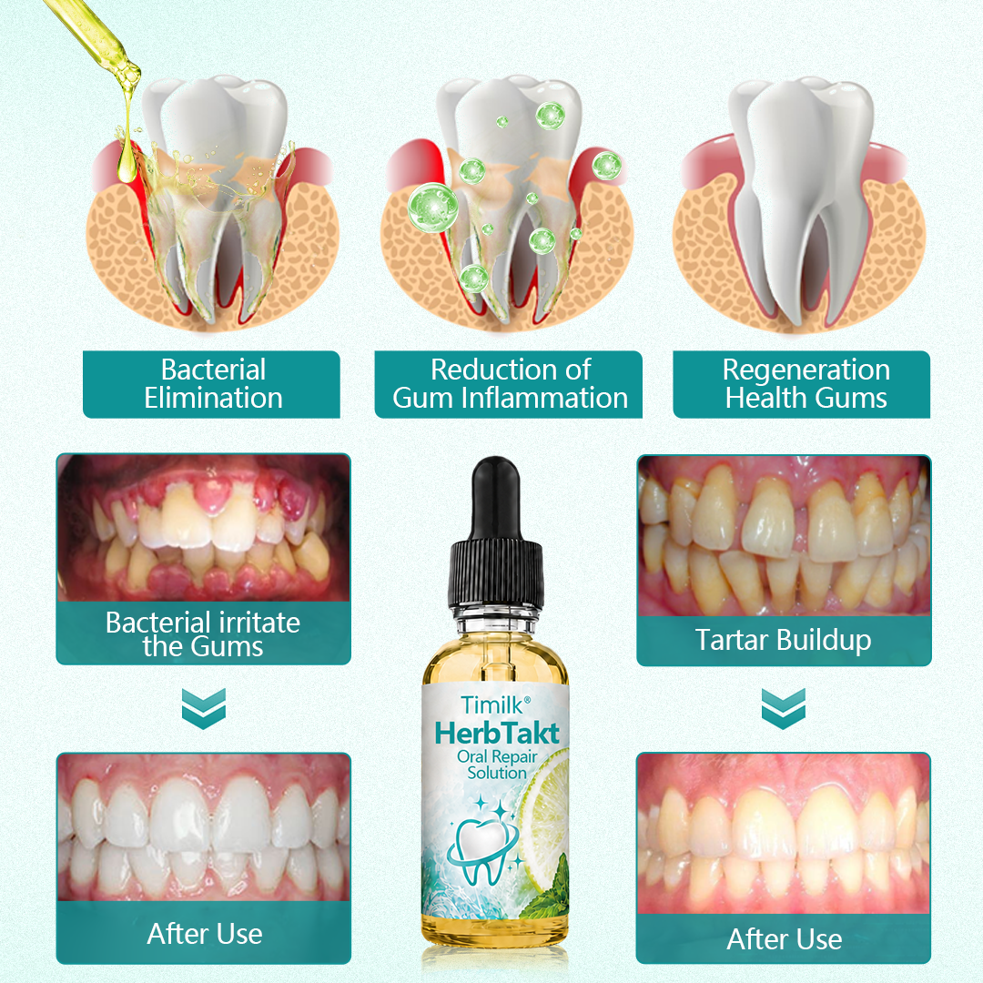 Timilk® HerbTakt Oral Repair Solution🔥（A）