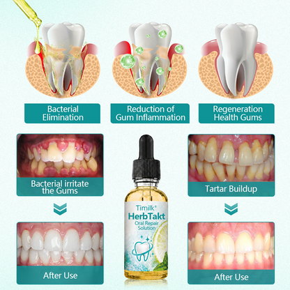 Timilk® HerbTakt Oral Repair Solution🔥（A）