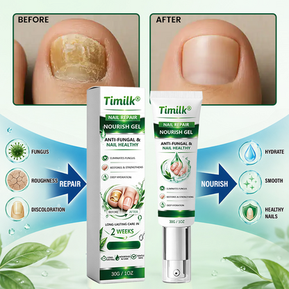 Timilk® Nail Repair Nourish Gel(A)