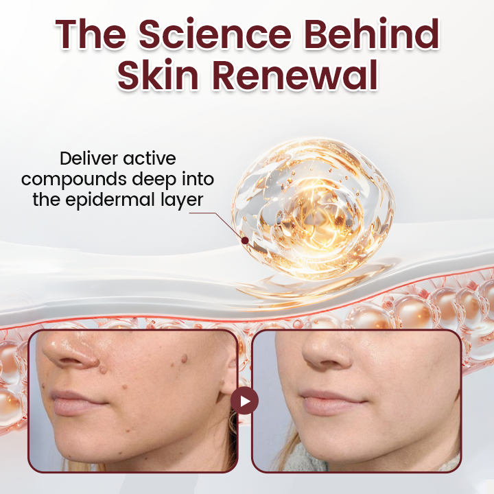 Timilk® BumpAway Gentle Renewal Cream🔥（A）