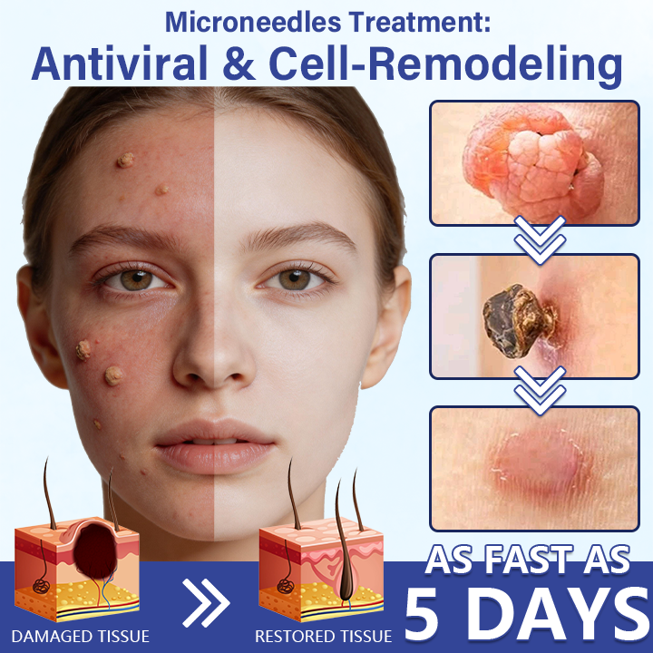 🔥Timilk® DermalRepair 2-in-1 Microneedle & Hydrocolloid Patch 💉| Raised Moles, Acne, Flat Warts & Skin Tags Remover | Improves Wrinkles, Scars & Blemishes | Invisible Pimple Patches for Face & Body💎🔥（A）