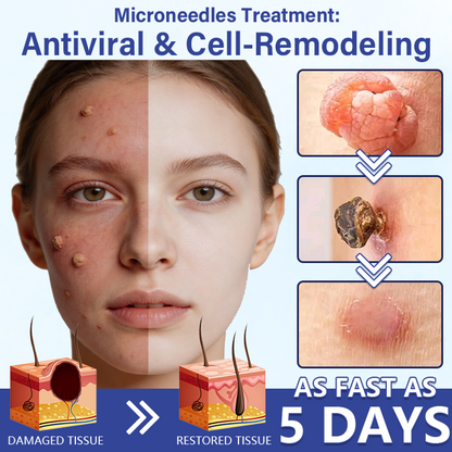 🔥Timilk® DermalRepair 2-in-1 Microneedle & Hydrocolloid Patch 💉| Raised Moles, Acne, Flat Warts & Skin Tags Remover | Improves Wrinkles, Scars & Blemishes | Invisible Pimple Patches for Face & Body💎🔥（A）