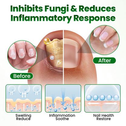 Timilk® HerbaNail 7-Day Repair Serum 🔥 FDA Certified (Clinically Proven Herbal Formula for 7-Day Nail Fungus Repair & Strength Restoration 🌿)(A)
