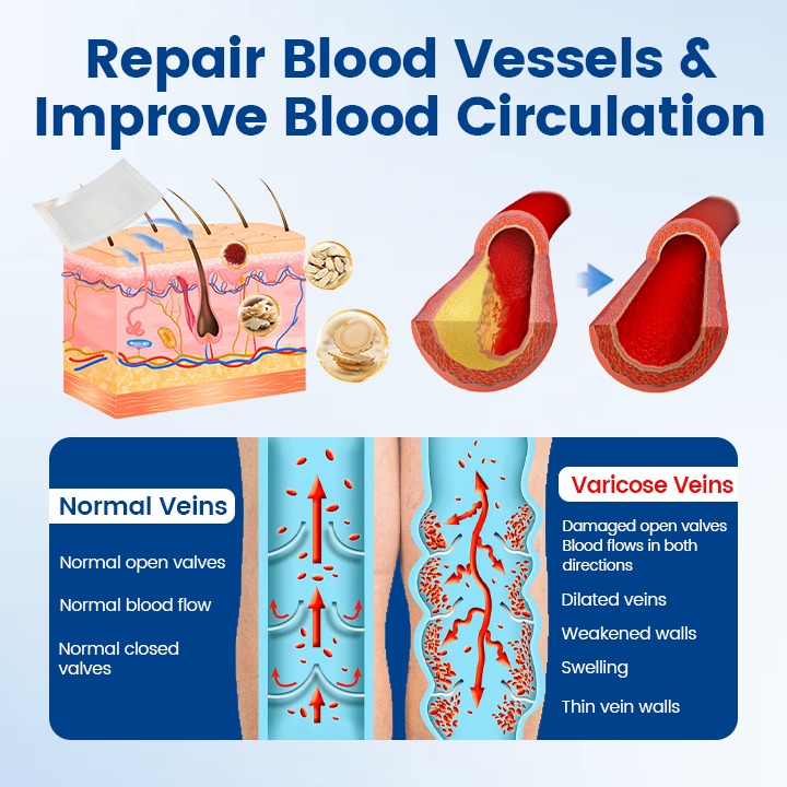 Timilk® Vein Ease Microneedle Therapy Patch - Fast ⚡Effective 💪 and Non-Invasive 🚫 Treatment for Varicose Veins & Leg Swelling 👣(A)