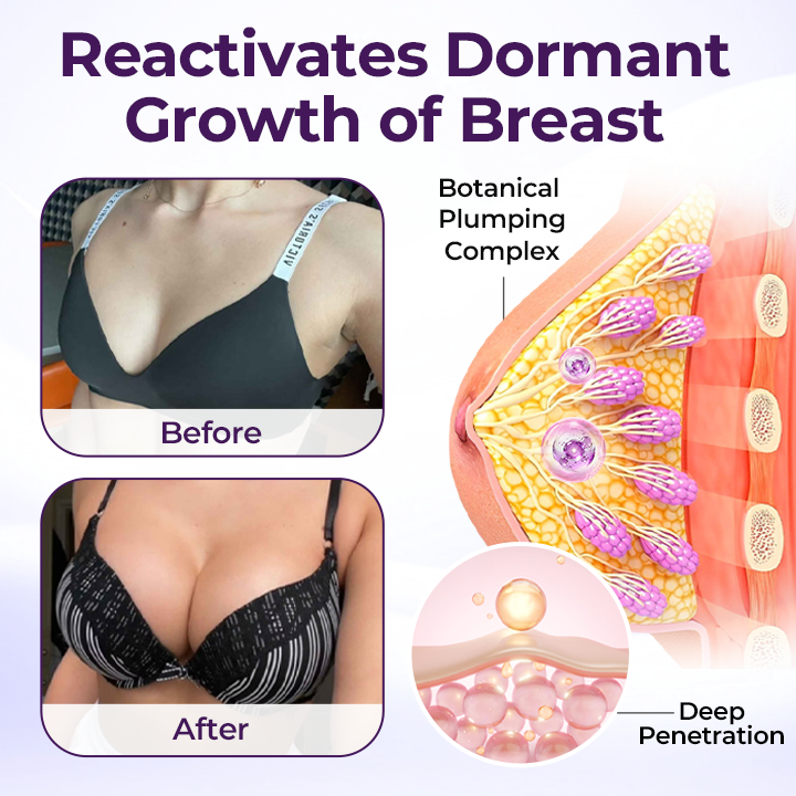 Timilk® Maxcurve Lift & Plump Bust Cream(A)