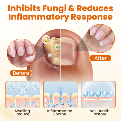 Timilk® FungiBee Advanced Nail Repair Spray (A)