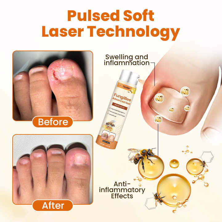 Timilk® FungiBee Advanced Nail Repair Spray (A)