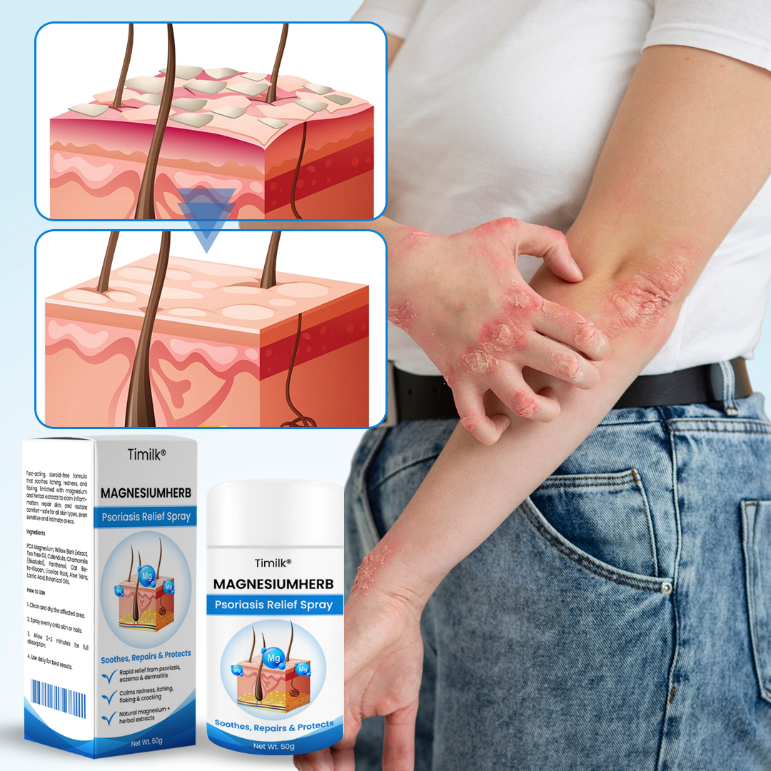 Timilk® MagnesiumHerb Psoriasis Relief Cream(A)