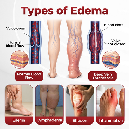 Timilk® SwellVeil Leg Circulation Cream 🔥(A)