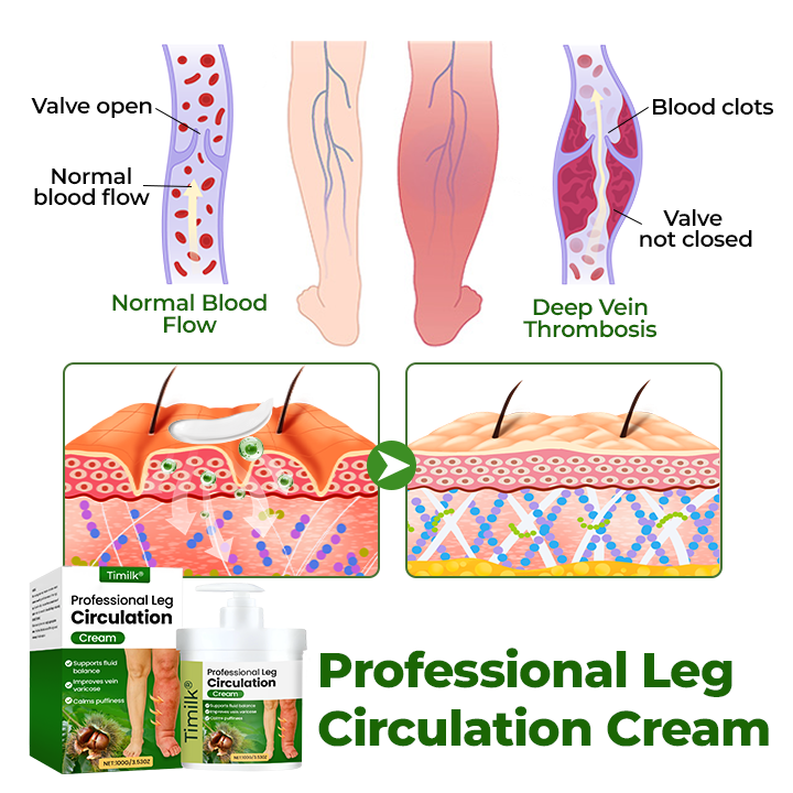Timilk®Professional Leg Circulation Cream 🔥(A)