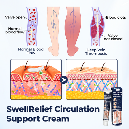 Timilk® SwellRelief Circulation Support Cream(A)