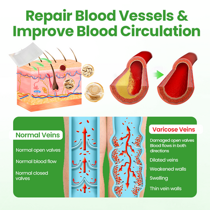 Healrize® VeinHeal Microneedle Patch,