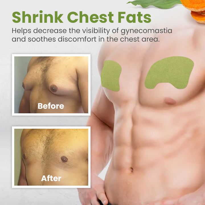 Ceoerty™ CeoGuard Gynecomastia Compression Patch🔥(A)